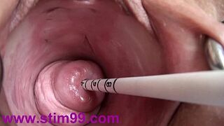 Extreme Real Cervix Fucking Insertion Japanese Sounds and Objects in Uterus