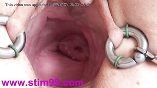 Extreme Real Cervix Fucking Insertion Japanese Sounds and Objects in Uterus