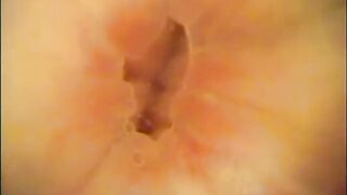 Japanese rectal exam