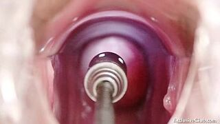 Hot blond babe vagina examination and enema