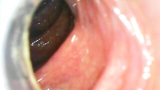 USB Endoscope ass withdraw 80cm deep