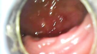 USB Endoscope ass withdraw 80cm deep