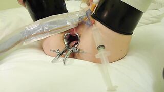 Catheter in Amanda