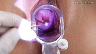 Ria Gyno Exam
