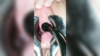 Peehole play 18