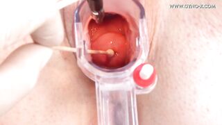 Melanie Gyno Exam
