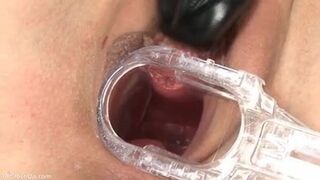 Yes, Doctor's Instruments Can be Great Fun :)