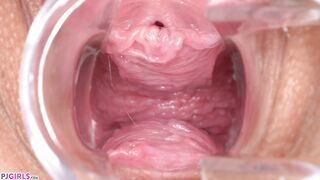 Speculum in motion