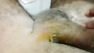 depyl 3