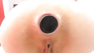 anal dild