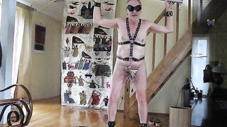 CBT with clothpinns and whipp