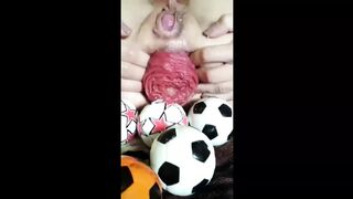 Anal Prolapse Extravaganza