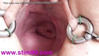 Extreme Real Cervix Fucking Insertion With Japanese Audio