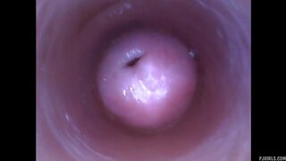 amateur7182