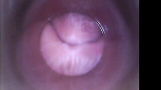 amateur7182