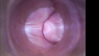 amateur7182