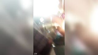 Surgical fuck