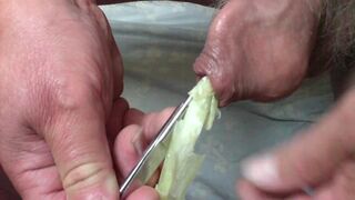 Combination - spring onion AND scissors in foreskin !