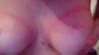 bruised cow tits