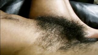 Hairy hairy hairy