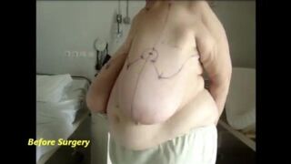 Saggy