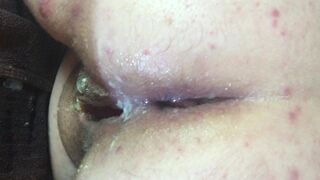 Meg's arse after a good anal fucking and cream pie closeup