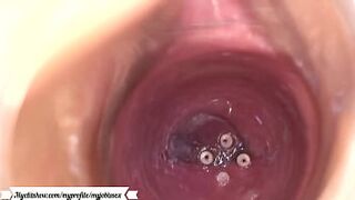 Camera in the vagina