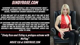 Sindy Rose anal fisting & prolapse extreme with MrPlay