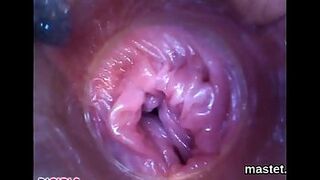 Licky Lex, Silvia Dellai-RAW Endoscopic Video-2017-01-26l 1