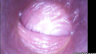 Licky Lex, Silvia Dellai-RAW Endoscopic Video-2017-01-26l 1