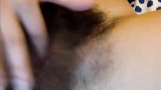 Extremely hairy!