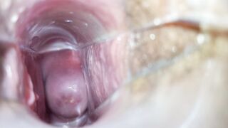 Speculum inside pussy