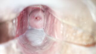 Cum inside pussy close-up speculum