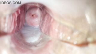 Cum inside pussy close-up speculum