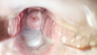 Cum inside pussy close-up speculum