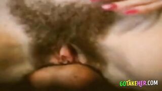 Hairy anal