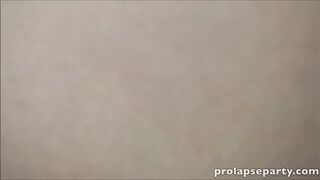 Mash and prolapse play
