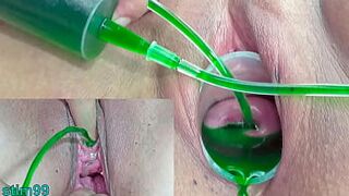 Cervix and Pee Hole Inflation with Injections for Japanese Lesbians