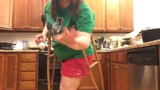 hip amputee
