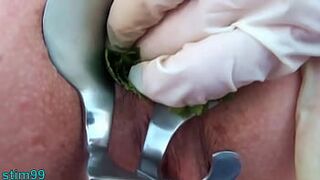 Nettles Ass Fisting Anal Insertion Nettles with Speculum