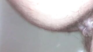 Fantastic medical endoscope exploration of this sweaty and dirty ass hole
