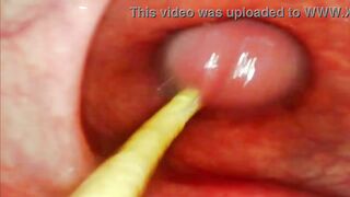EXTREME ANAL POV. CAMERA INSIDE HER ASSHOLE AS I POUND HER WITH MY BIG COCK AND CUM DEEP INSIDE