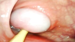 EXTREME ANAL POV. CAMERA INSIDE HER ASSHOLE AS I POUND HER WITH MY BIG COCK AND CUM DEEP INSIDE