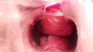 Gyno Cam Close-Up Vagina Cervix Siswet19 — my chat www.sheer.com/siswet
