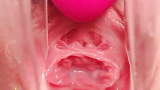 Gyno Cam Close-Up Vagina Cervix Siswet19 — my chat www.sheer.com/siswet