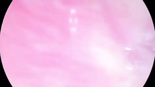 Camera deep inside of the wet pussy and captured the intense female orgasm!!