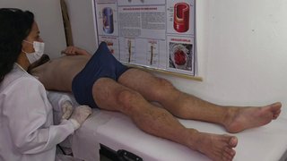 Nurse Observes Patient's Erection