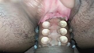 Homemade anal teen