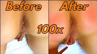 Enormous Pussy Swelling during long Spanking Session (100 Hits on Perfect Ass)