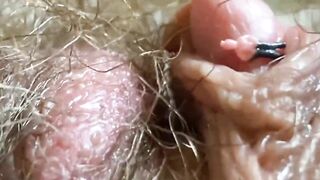 Huge Clit